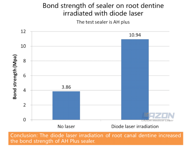 Laser increase the bond strength of sealer