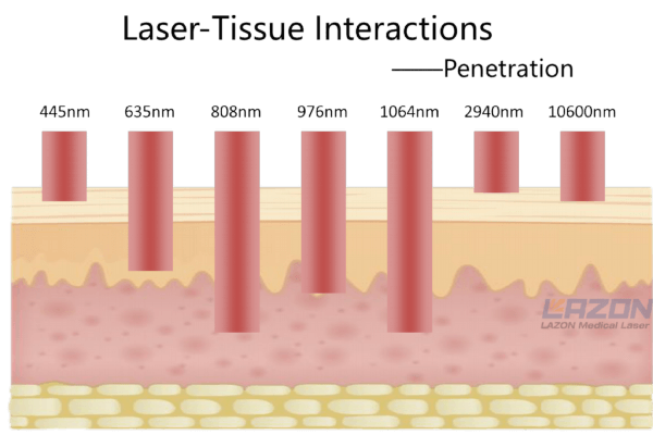 Laser penetration into tissue