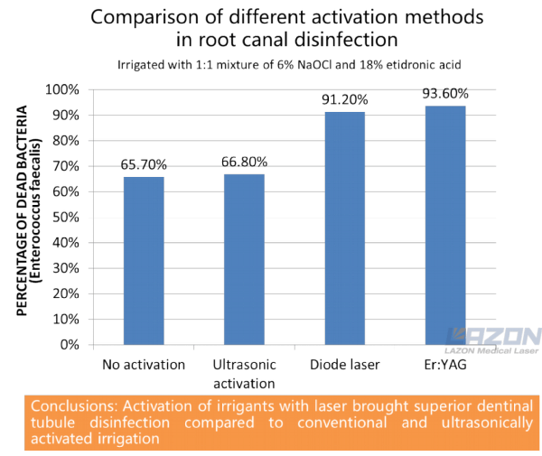 Activation of irrigants with laser in root canal disinfection