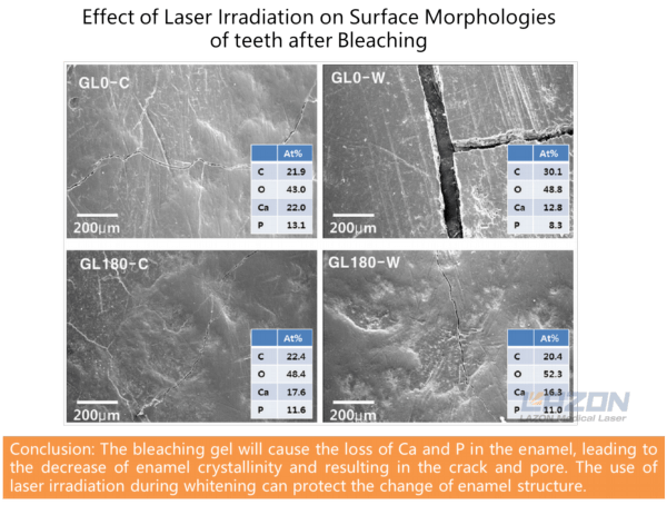 Surface morphologies of teeth after laser whitening